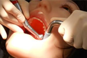 dentaroid3